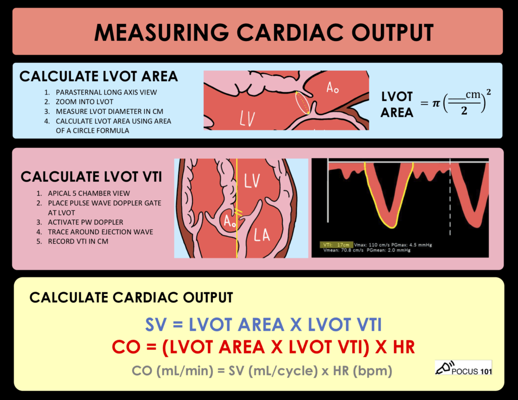 How to Measure Stroke Volume?