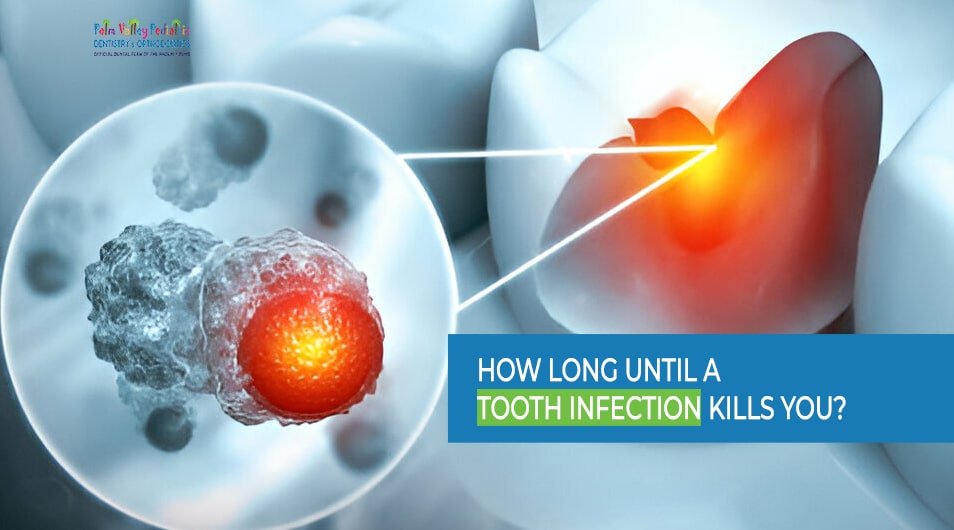 How Long Until a Tooth Infection Kills You?